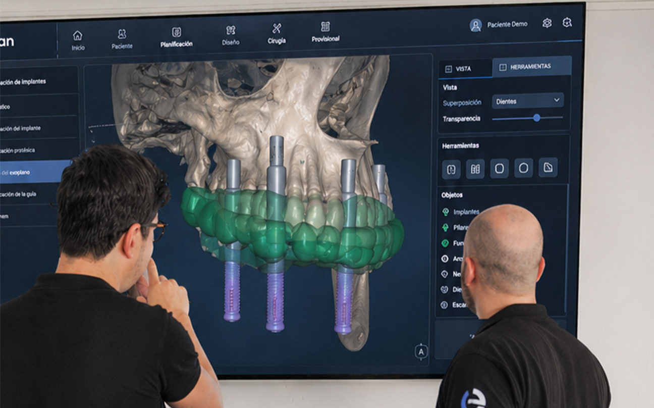 Diseño dental CAD/CAM