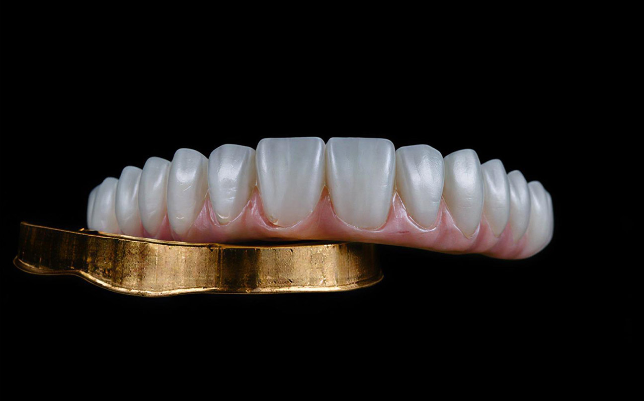 Servicios dentales premium